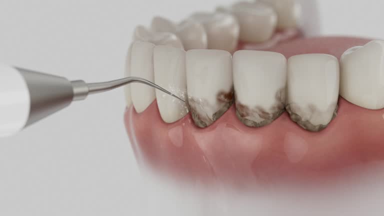 Reliable Dental Crowns And Bridges contractor in Jefferson Davis Parish County, LA by Dentist Open Now